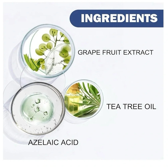 NWT Acne and Spots Cleansing Lotion Relief 50ml for Dry Skin Facial Cleanser - Picture 10 of 11